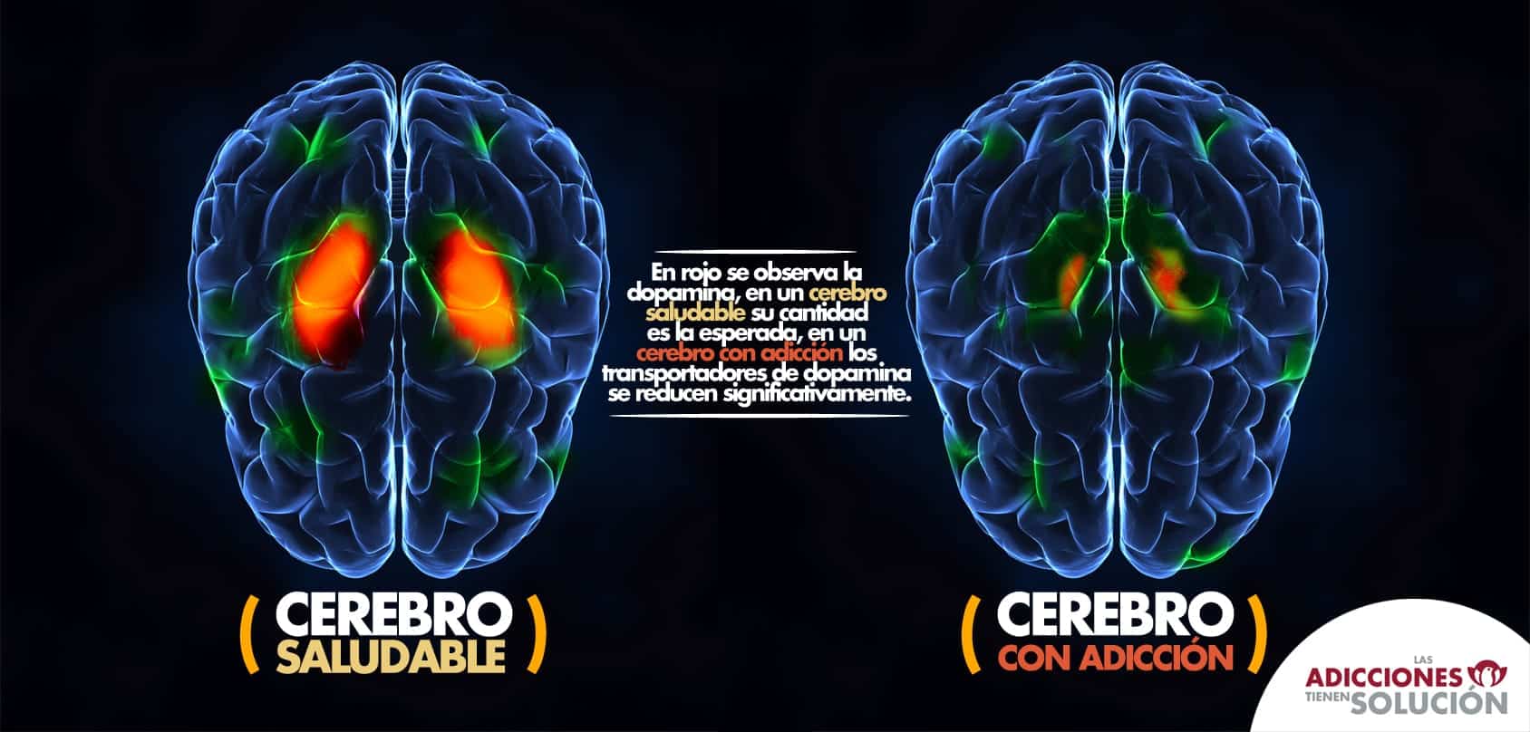 Cerebro